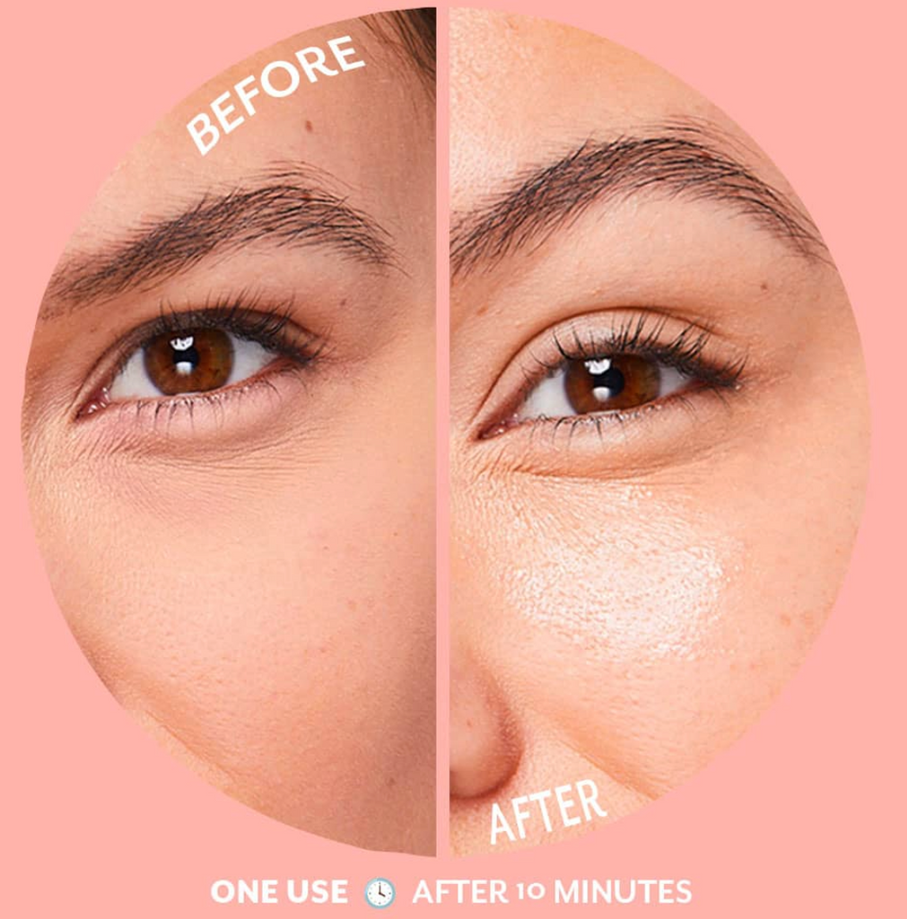 Patchology Serve Chilled Eye Gels ~ Bubbly