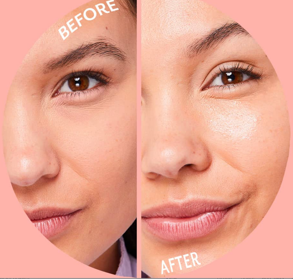 Patchology Serve Chilled Bubbly Hydrogel Face Mask